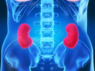 Why do stones form in the kidney?