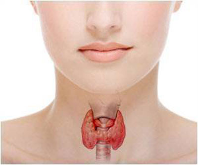 Hyperparathyroidism leads to formation of kidney stones