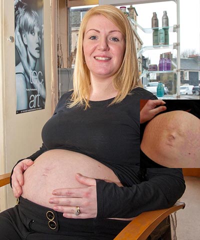 Mum with baby's face on tum, it's a pregnant Karen McMartin's belly button idea