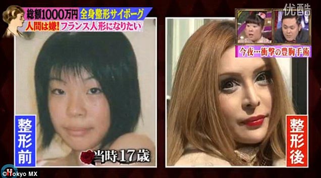 Japanese model Vanilla Chamu spent $100k on plastic surgery for french doll look